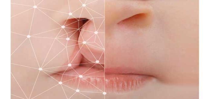 Tecnología 3D mejora la cirugía de labio leporino y paladar hendido