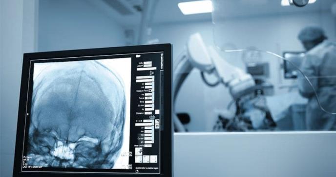 Los síntomas que alertan de una futura esclerosis múltiple
