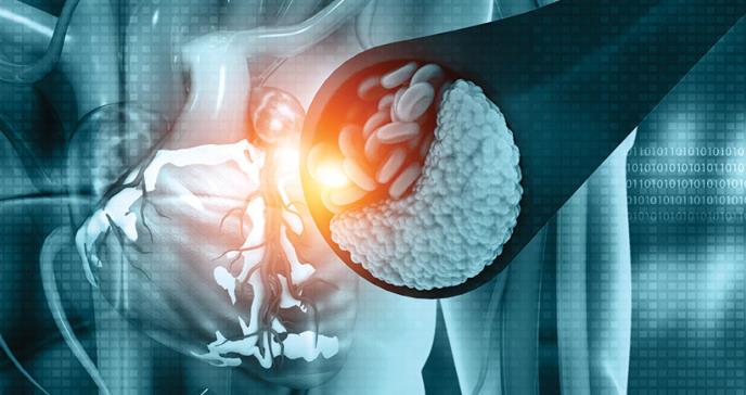 Manejo de hiperlipidemia en el paciente diabetico