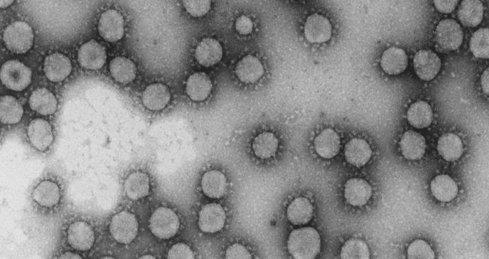 Resultado prometedor de un fármaco contra el mieloma que logra frenar un coronavirus humano