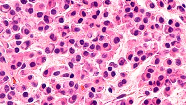 Identifican posible fórmula para crear vacuna contra cáncer de sangre Identifican posible fórmula para crear vacuna contra cáncer de sangre
