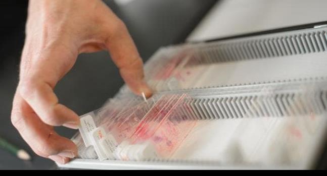 Miles de mujeres con cáncer de mama pueden decir adiós a la quimioterapia
