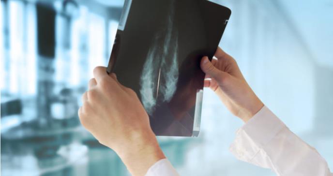 Se reducen las muertes por cáncer en Estados Unidos