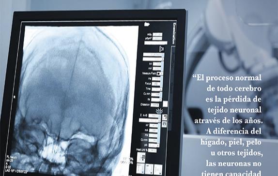 Neuroimagen en Enfermedades Neurodegenerativas