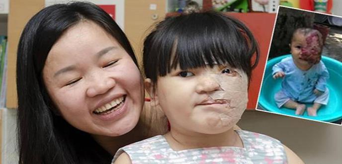 Un nuevo rostro para la niña que nadie quería mirar