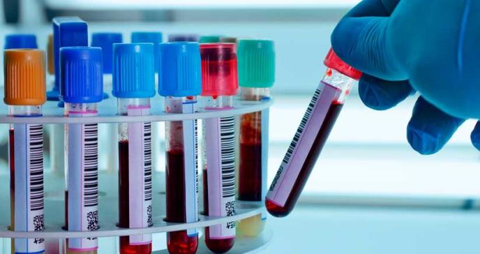 Nuevo análisis de sangre predeciría si una persona envejece de forma acelerada