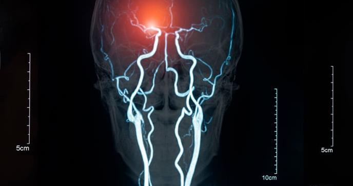 Interior paraliza un experimento de estimulación eléctrica cerebral con presos violentos