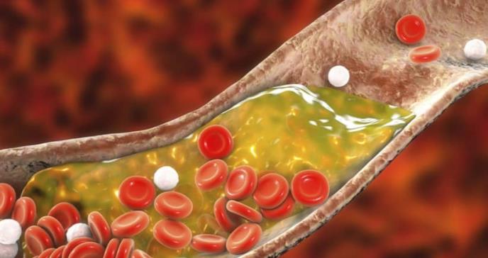 Un nuevo probiótico con una elevada capacidad de reducción del colesterol