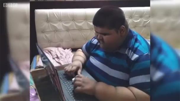 Cómo perdió un tercio de su peso el adolescente más obeso del mundo