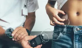 Páncreas artificial logra controlar eficazmente la diabetes en pacientes pediátricos