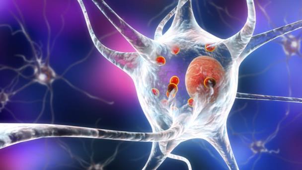 Tratamientos quirúrgicos y no quirúrgicos en el manejo de la enfermedad de Parkinson