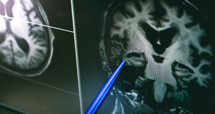 Pequeña área del cerebro encargada de regular las interacciones humanas