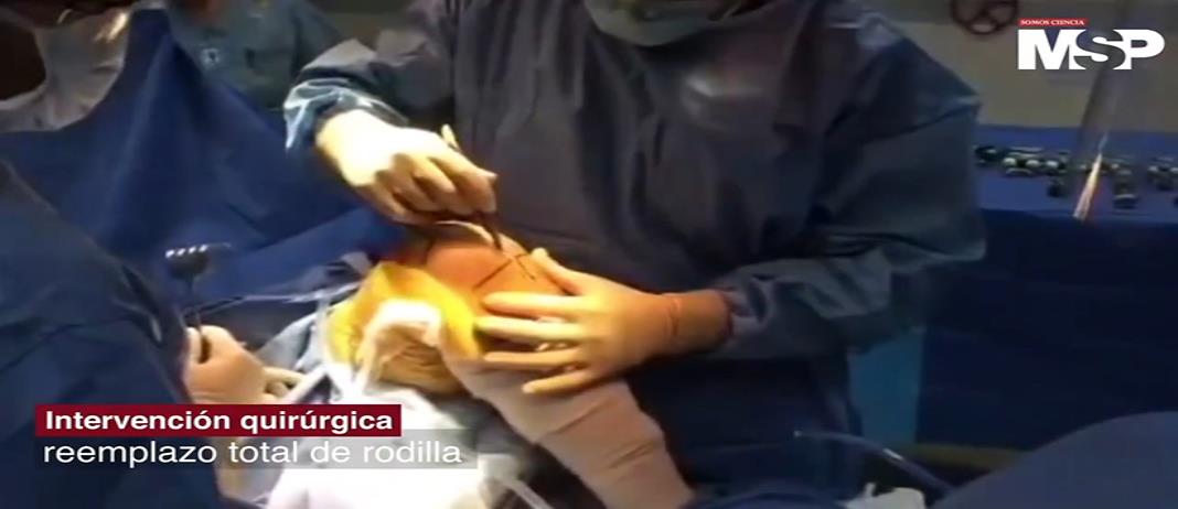 Reemplazo de rodilla primicia MSP