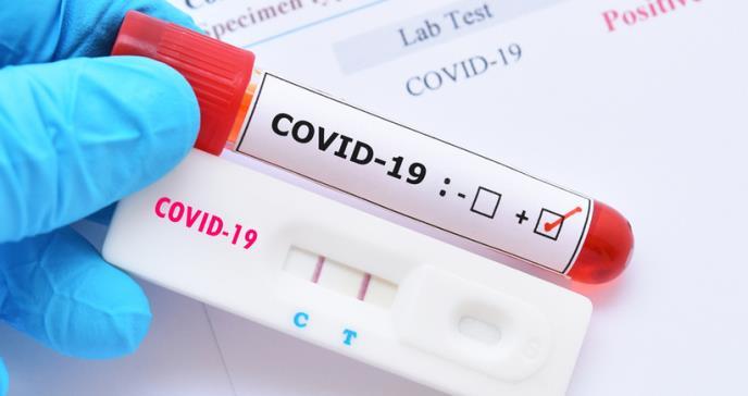 Funcionarios del Departamento de Salud de PR arrojan positivo a COVID-19