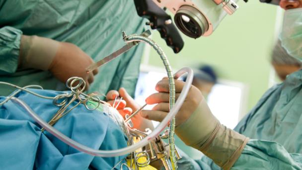 Primera cirugía láser para epilepsia y tumor cerebral
