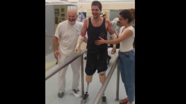 Los primeros pasos del joven que perdió las cuatro extremidades a causa de una meningitis