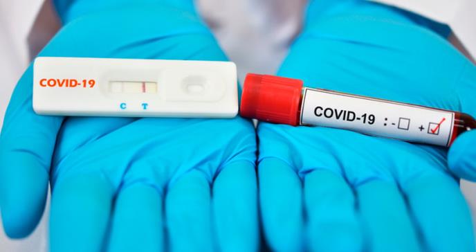 La prueba rápida, serológica o de anticuerpos no debe ser utilizada como una prueba diagnóstica