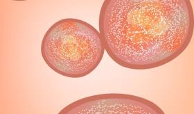 Relacionan la psoriasis con enfermedades cardíacas en puertorriqueños