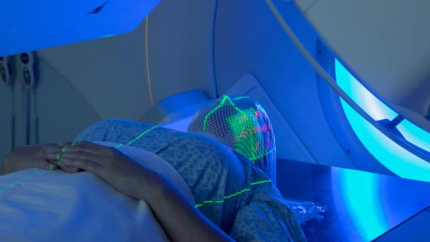 Nueva radioterapia para cáncer cerebral preservará la función cognitiva Nueva radioterapia para cáncer cerebral preservará la función cognitiva