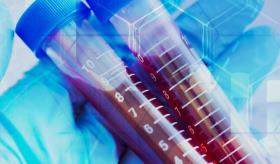 Reportan segundo caso internacional de curación de VIH