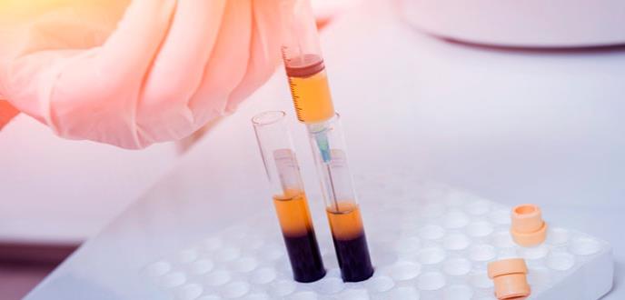 Un análisis de suero sanguíneo mejora el diagnóstico de enfermedades oncológicas