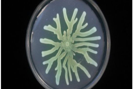 Las bacterias resistentes readaptan su metabolismo para mejorar su supervivencia