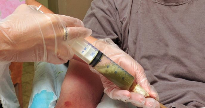 Cannabis como medicina contra el cáncer