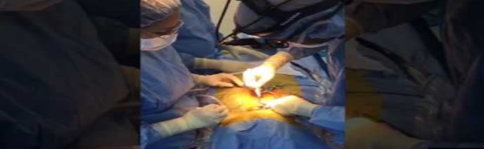 En directo desde el quirófano: Cirugía de reemplazo del disco cervical