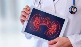 Efectivo tratamiento de inmunoterapia con anticuerpos monoclonales para tratar el cáncer de riñón