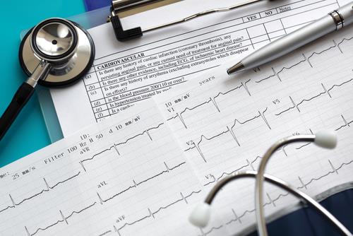 Confirman validez de electrocardiograma para mejorar la prevención de la muerte súbita en jóvenes Confirman validez de electrocardiograma para mejorar la prevención de la muerte súbita en jóvenes