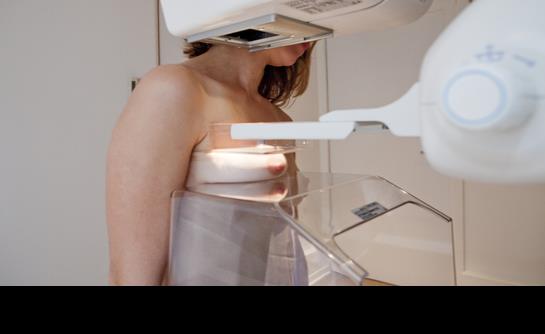 Expertos apuntan a un cambio de paradigma en el tratamiento del cáncer de mama hereditario