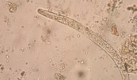 Molécula parasitaria podría ayudar con la enfermedad de Crohn