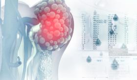Sintomatología y prevención del cáncer de riñón