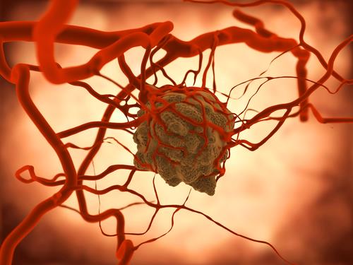 El cáncer de páncreas metastásico se reprograma para la malignidad El cáncer de páncreas metastásico se reprograma para la malignidad