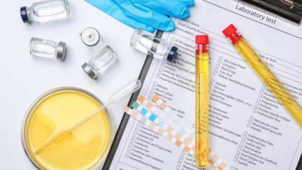 Terapia hormonal de testosterona no beneficia a todos los pacientes Terapia hormonal de testosterona no beneficia a todos los pacientes