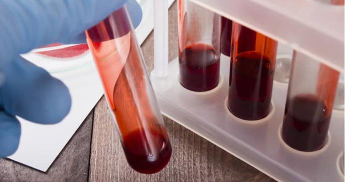 Test de sangre identifica síntomas de alzhéimer 20 años antes del desarrollo de la enfermedad