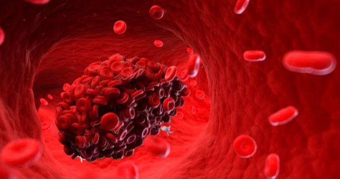 Importancia de la medicina interna en la prevención del tromboembolismo venoso