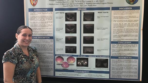 Tumor de ovarios se presenta en testículo de un puertorriqueño