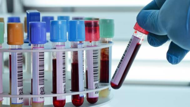Un test de sangre detecta siete tipos de cáncer con una única muestra