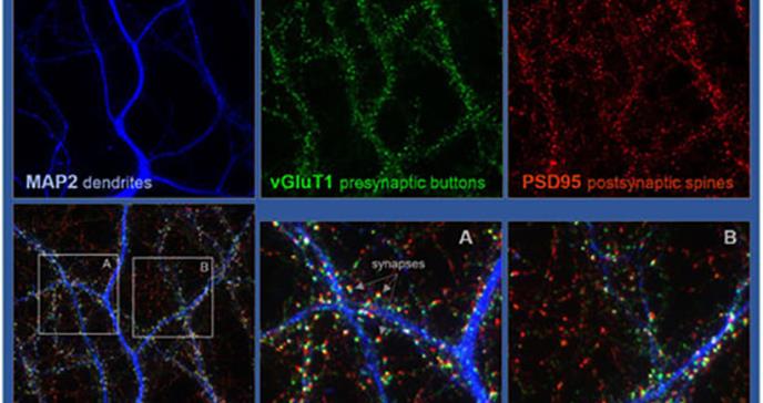 Una proteína cerebral promueve la interconectividad neuronal