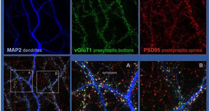 Una proteína cerebral promueve la interconectividad neuronal