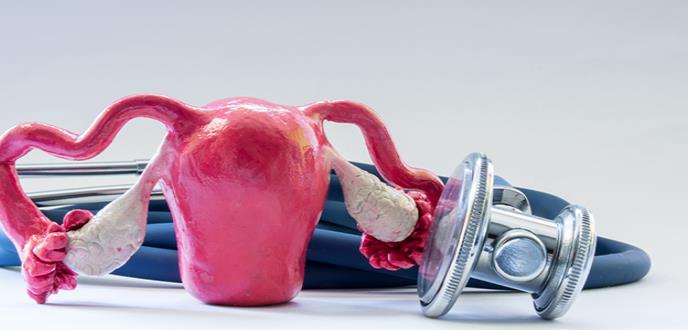 Nueva diana terapéutica contra la metástasis en cáncer de ovario