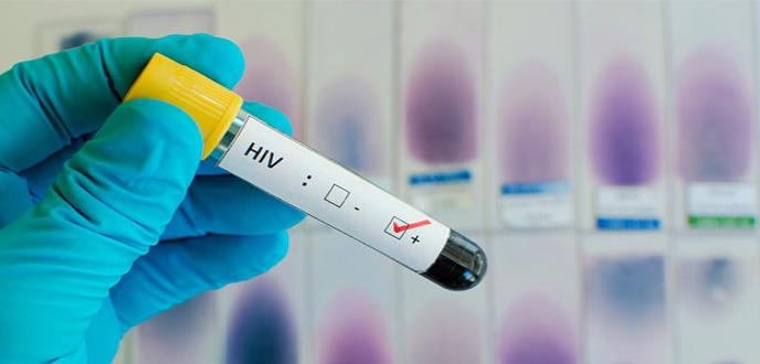 El VIH en 2017: avances en su prevención, tratamiento y cura