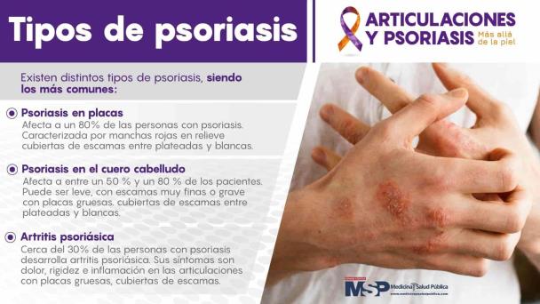 Tipos de Posiriasis