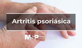 Artritis psoriásica