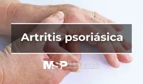 Artritis psori&aacute;sica