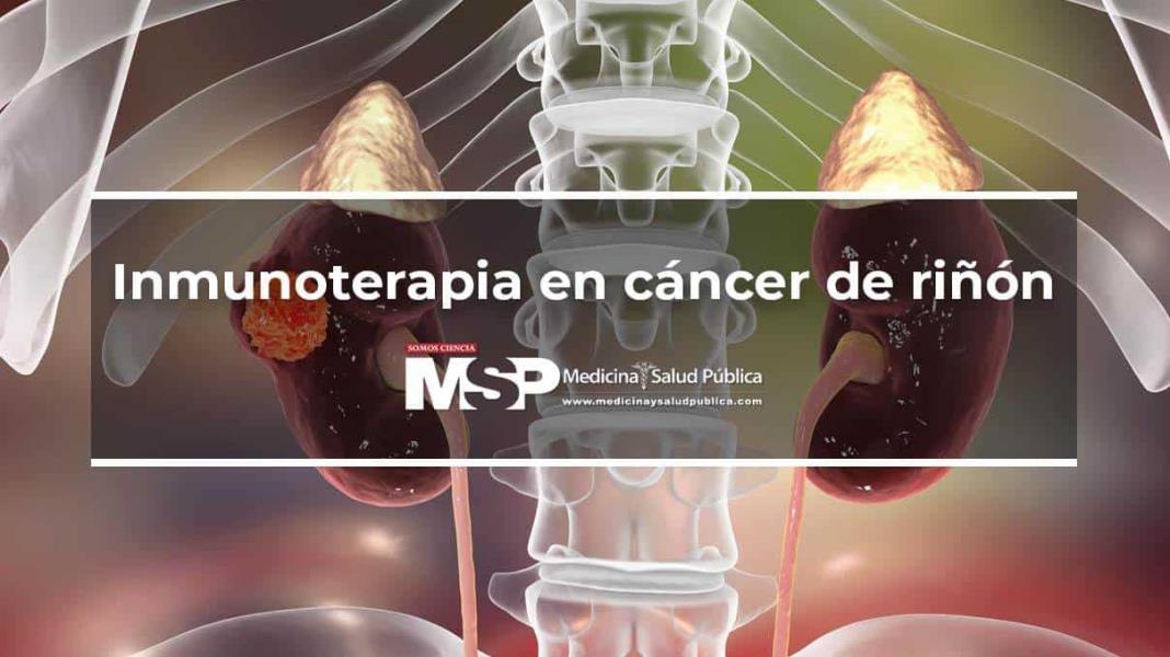 Inmunoterapia en cáncer de riñón
