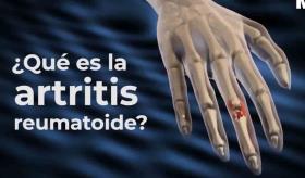 ¿Qué es la artritis reumatoide?