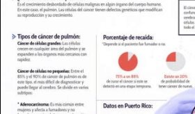 ¿Qué es el cancer de pulmón?