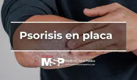 Psoriasis en Placa
